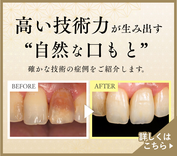 確かな技術の症例をご紹介します